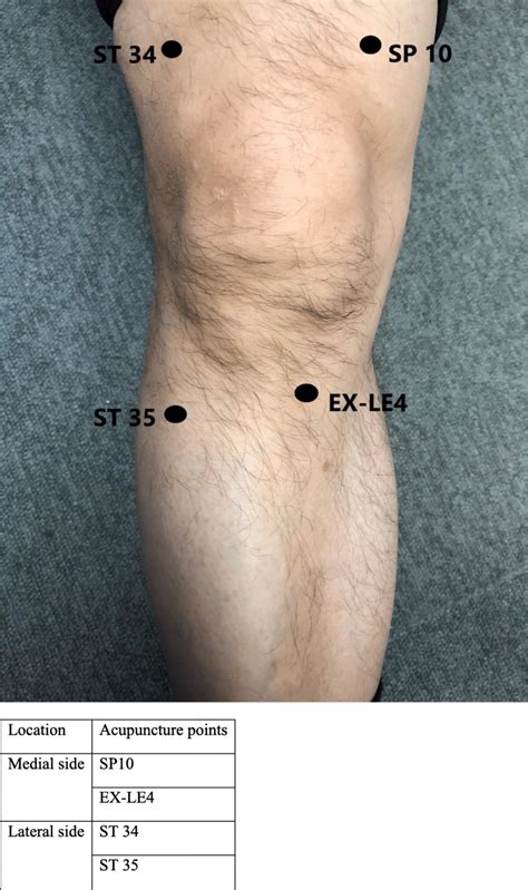 Acupuncture 的图像结果