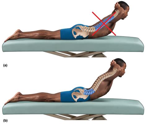 Image result for Contralateral Lateral Flexion