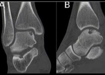 Best Orthopaedic Doctor in Kalwa, Thane | Dr. Vivek Maurya