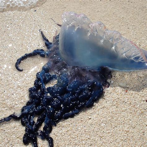 Man O War Jellyfish Sting Portuguese Men O' War Spotted On Local