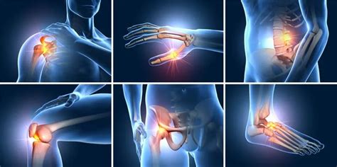 Is It Arthritis or Joint Pain? Signs, Symptoms & Treatment