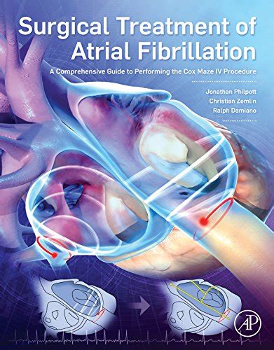 Surgical Treatment of Atrial Fibrillation: A Comprehensive Guide to ...