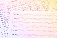 Image result for Neural Scanner