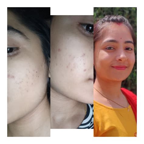 Turmeric Kojic Acid Pads – The Sassy Company