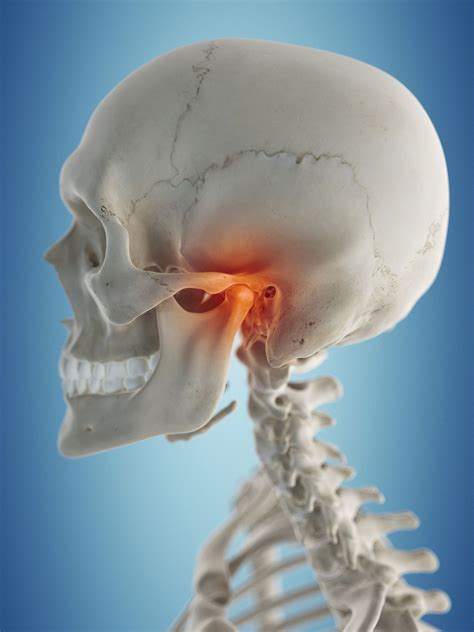 Is Your Neck Pain Related to Your Jaw Joint?