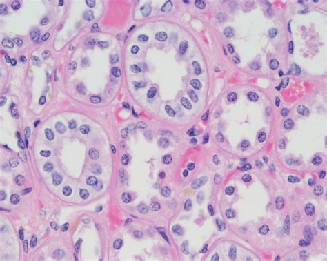 Simple Cuboidal Epithelium Slide 400x