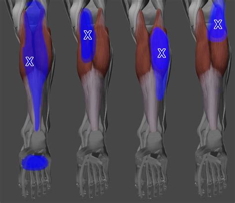 Acupuncture for Calf Trigger Points — Morningside Acupuncture NYC