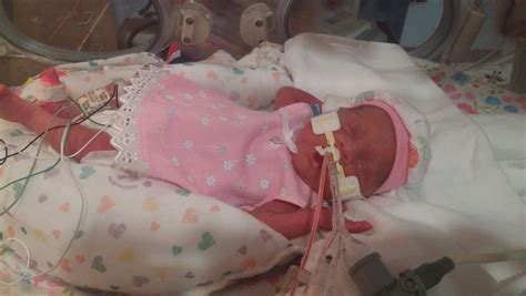 23 Week Fetus In The Womb