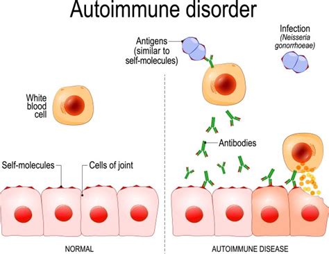 Autoimmunity 的图像结果