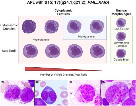 Phenotypic clues that predict underlying cytogenetic/genetic ...