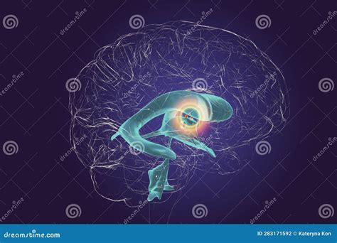 The Interventricular Foramen, Also Known As the Foramen of Monro, 3D Illustration. Stock ...