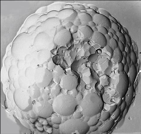 Local Anesthesia 的图像结果