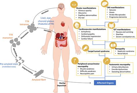 Frontiers | Contributions of Animal Models to the Mechanisms and Therapies of Transthyretin ...