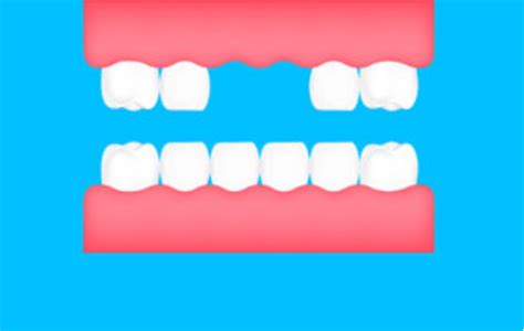 北京牙齿矫正：关于龅牙最详细的一篇分析 - 知乎