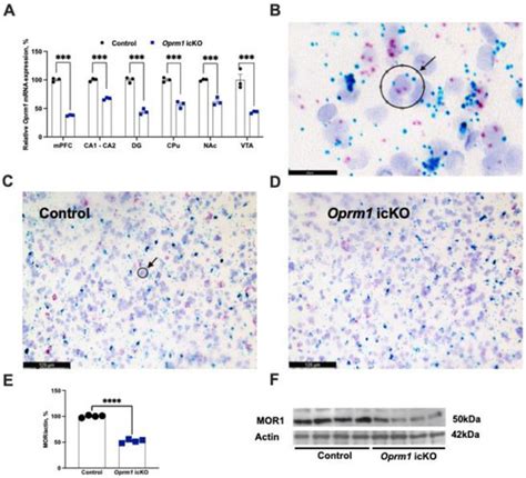 Loss of Astrocytic µ Opioid Receptors Exacerbates Aversion Associated ...