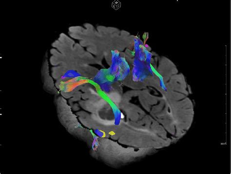Image result for fMRI Python