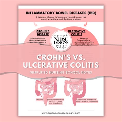 Crohn's vs. Ulcerative Colitis Nursing Study Guide – OrganizedNurseDesigns