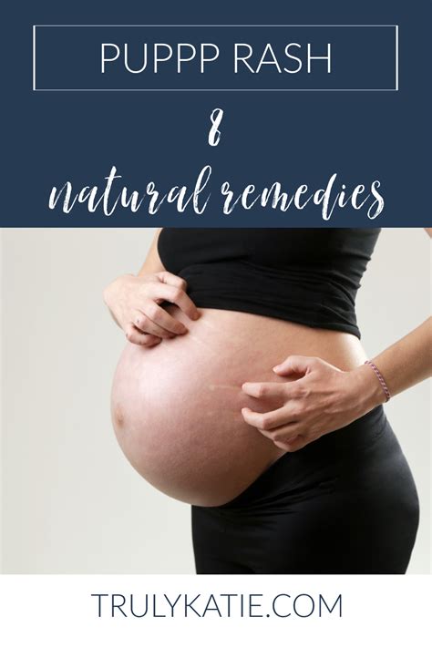 natural remedies rash