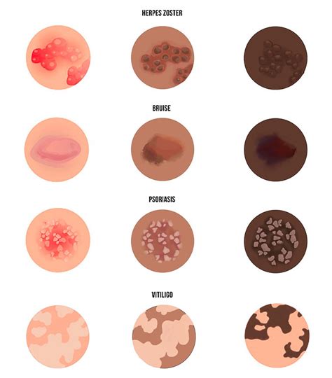 Image result for Different Types of Skin Conditions