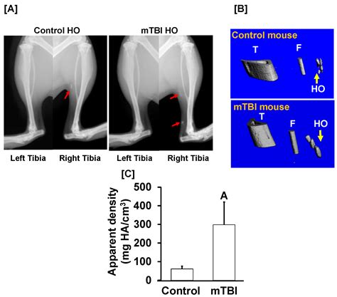 Development of an Animal Model for Traumatic Brain Injury Augmentation ...