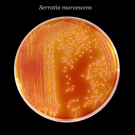 Serratia Marcescens Bacteria Symptoms