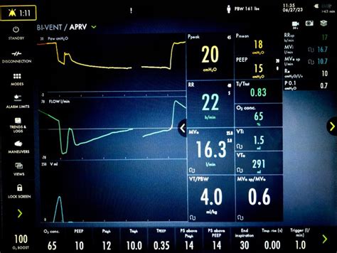 Aprv Basic Settings 的图像结果