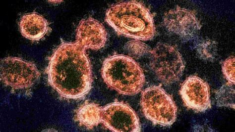 New study uncovers new details of SARS-CoV-2 interactions with human cells