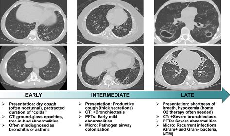 Frontiers | An AIREless Breath: Pneumonitis Caused by Impaired Central Immune Tolerance