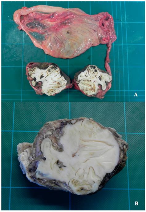 Dentigerous Equine Teratoma in a Stallion: Surgical Management and ...