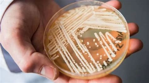 致命真菌在美国蔓延 近一半感染者90天内死亡_凤凰网健康_凤凰网