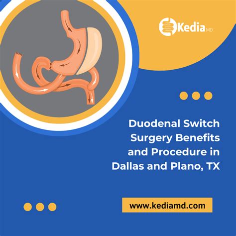 Duodenal Switch Surgery Benefits and Procedure in Dallas, TX