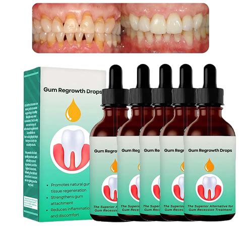 Coconut Oil Pulling Receding Gums at Alana Walden blog