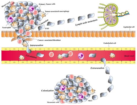 Sesquiterpene Lactones as Promising Phytochemicals to Cease Metastatic ...