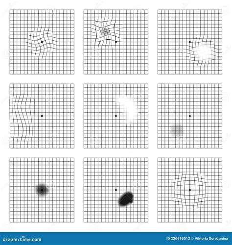 Amsler Eye Test Grid. Oculist Vector Printable Chart Retina Examination ...