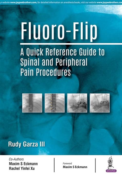 Fluoro-Flip: A Quick Reference Guide to Spinal and Peripheral Pain Pro
