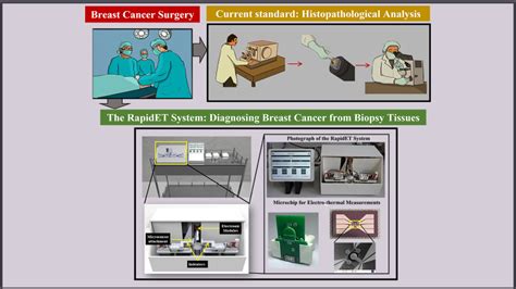 Novel technique, novel device: RapidET could be a gamechanger in cancer ...