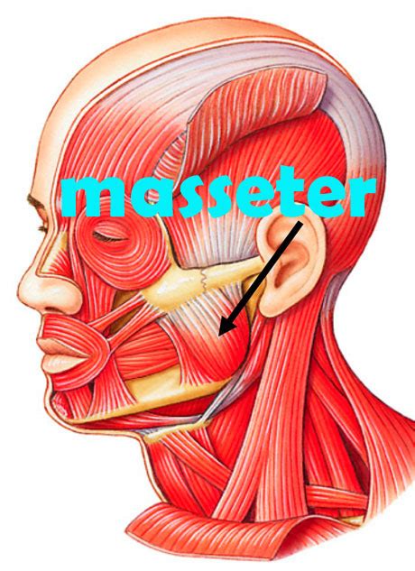 Image result for Masseter Muscle Trigger Point