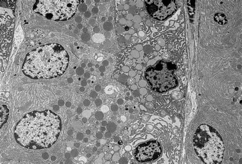 Image result for Electron Microscope Images