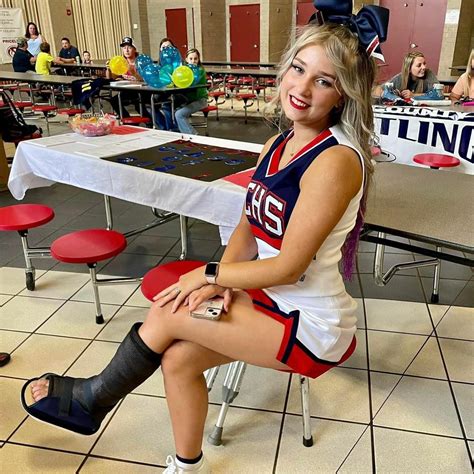 Pin by Adam Kaste on Quick Saves | Long leg cast, Leg cast, Broken ankle