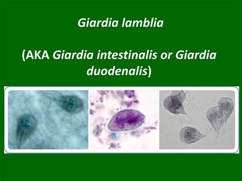 Giardia Lamblia Slide