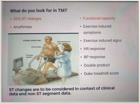 Treadmill stress testing | PPTX