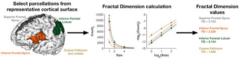 Cortical Complexity in Anorexia Nervosa: A Fractal Dimension Analysis