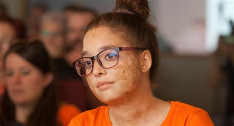 Leucemia mieloide aguda archivos - Fundación Josep Carreras contra la ...