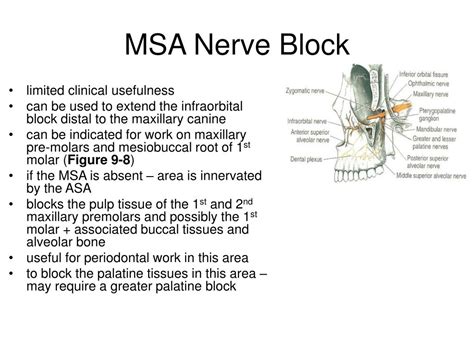 Local Anesthesia 的图像结果