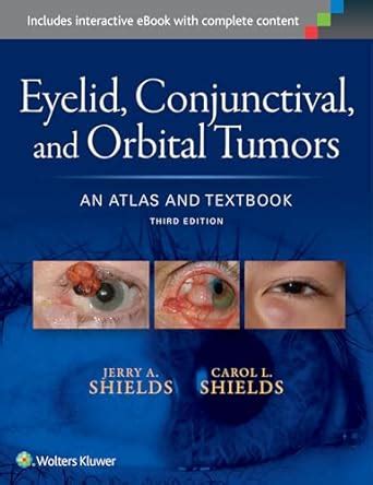 Buy Eyelid Conjunctival and Orbital Tumors an Atlas and Textbook 3ed ...