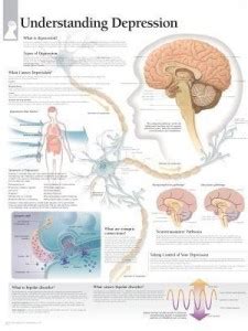 Understanding Depression Laminated Poster: Buy Understanding Depression ...