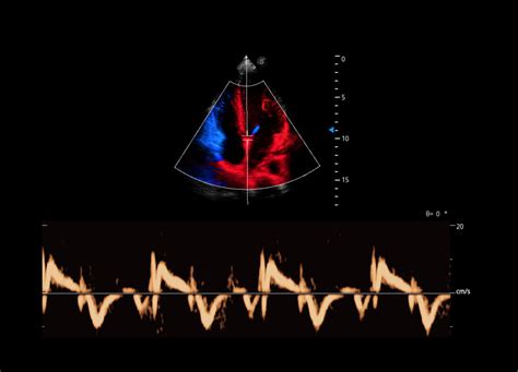 P60 | Intelligence Articulated | Sonoscape India