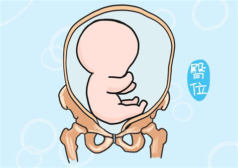 孕28周是胎儿的一道坎：为了宝宝能足月出生，孕妈要坚守住五件事_胎位