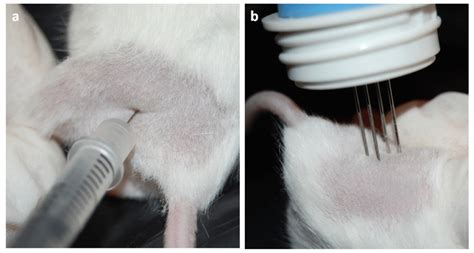 Chimeric DNA Vaccines against ErbB2+ Carcinomas: From Mice to Humans