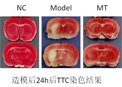 大鼠脑缺血再灌注模型--南京英瀚斯生物科技有限公司